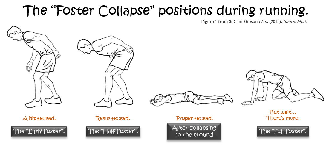 The foster collapse. Fatigue in runners and obstacle course race athletes from Thomas Solomon